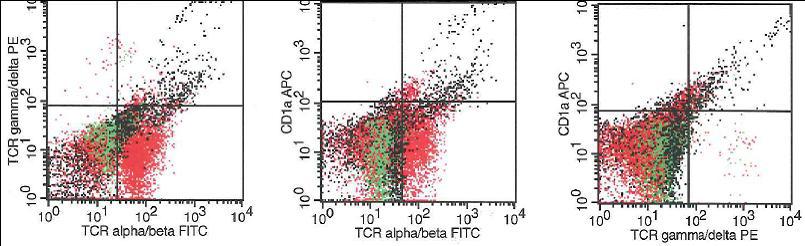 Atypical lymphoid cells lack both TCR alpha/beta and gamma/delta as well as CD1a